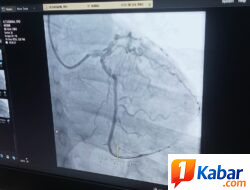 Proctoring Perdana Kateterisasi Jantung di RSUD Drs. H. Amri Tambunan Deli Serdang, 8 Pasien Jalani Tindakan